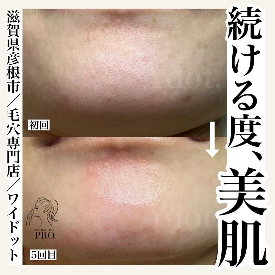 エステ Ydot. 池内 友架のエステ・リラクイメージ