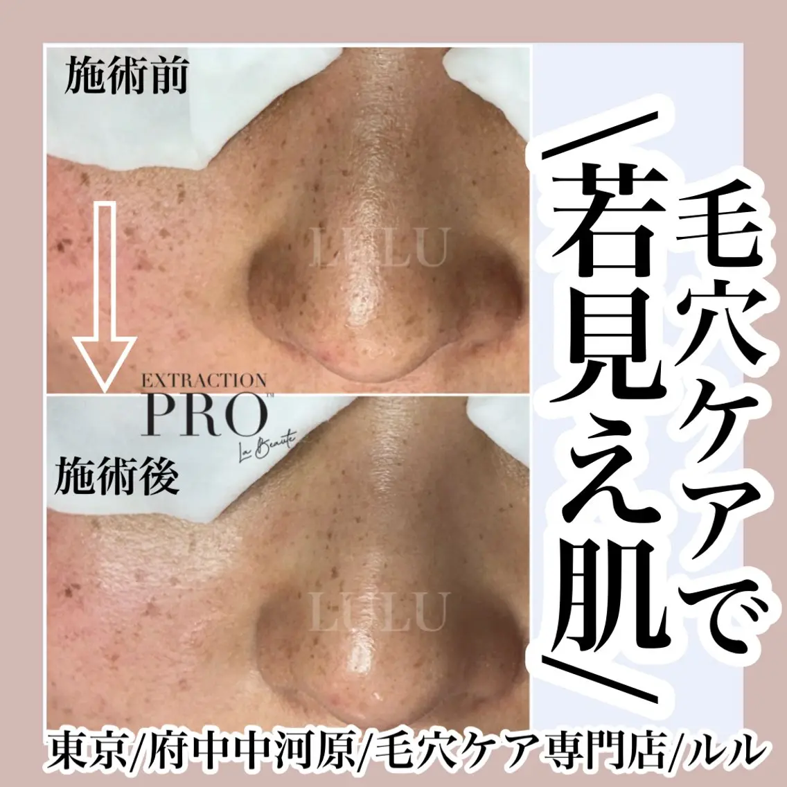 その他 LULU ルルのエステ・リラクイメージ