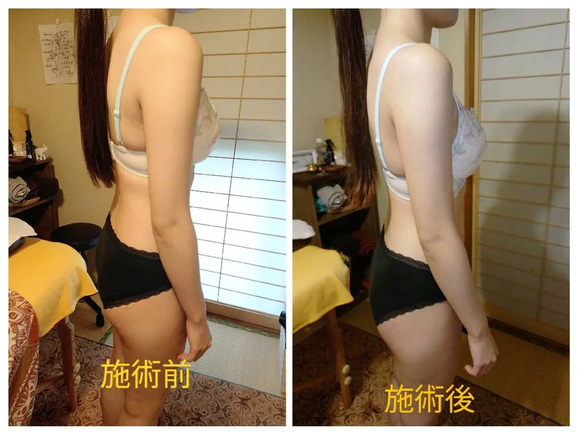 #限定コース 80分+5分 ★人気 圧なし軽め全身ケア ※延長も可能でご相談♪※施術前後写メ協力 包みこみバストケア無料の写真