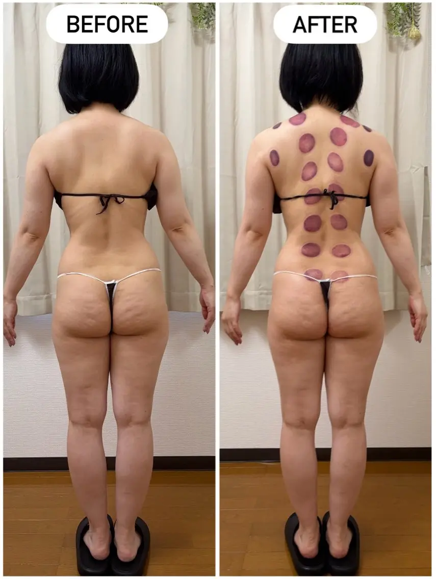 撮影モニター募集❗️よもぎ蒸し30分+上半身マッサージ60分の写真