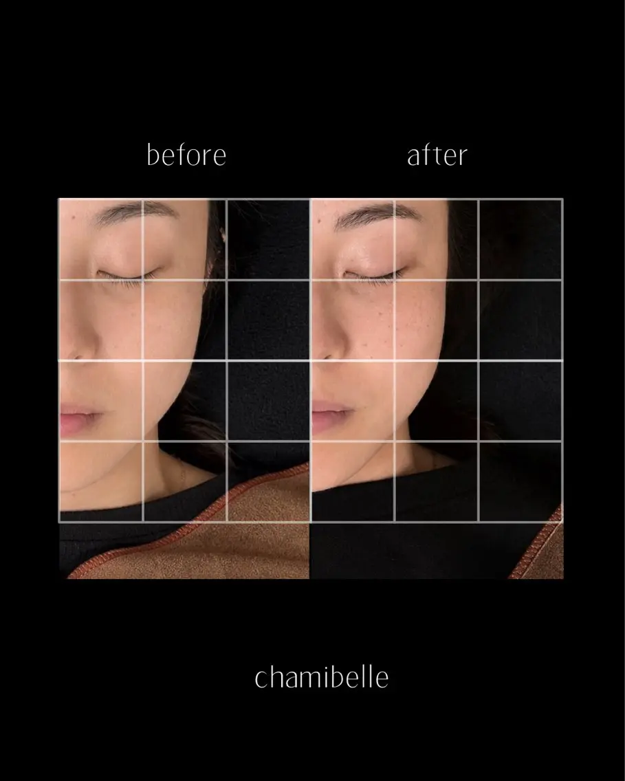 美容鍼灸サロン Chamibelleのエステ・リラクイメージ