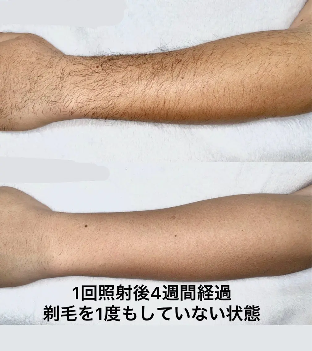 【本格脱毛】 グレイスフルルームのエステ・リラクイメージ
