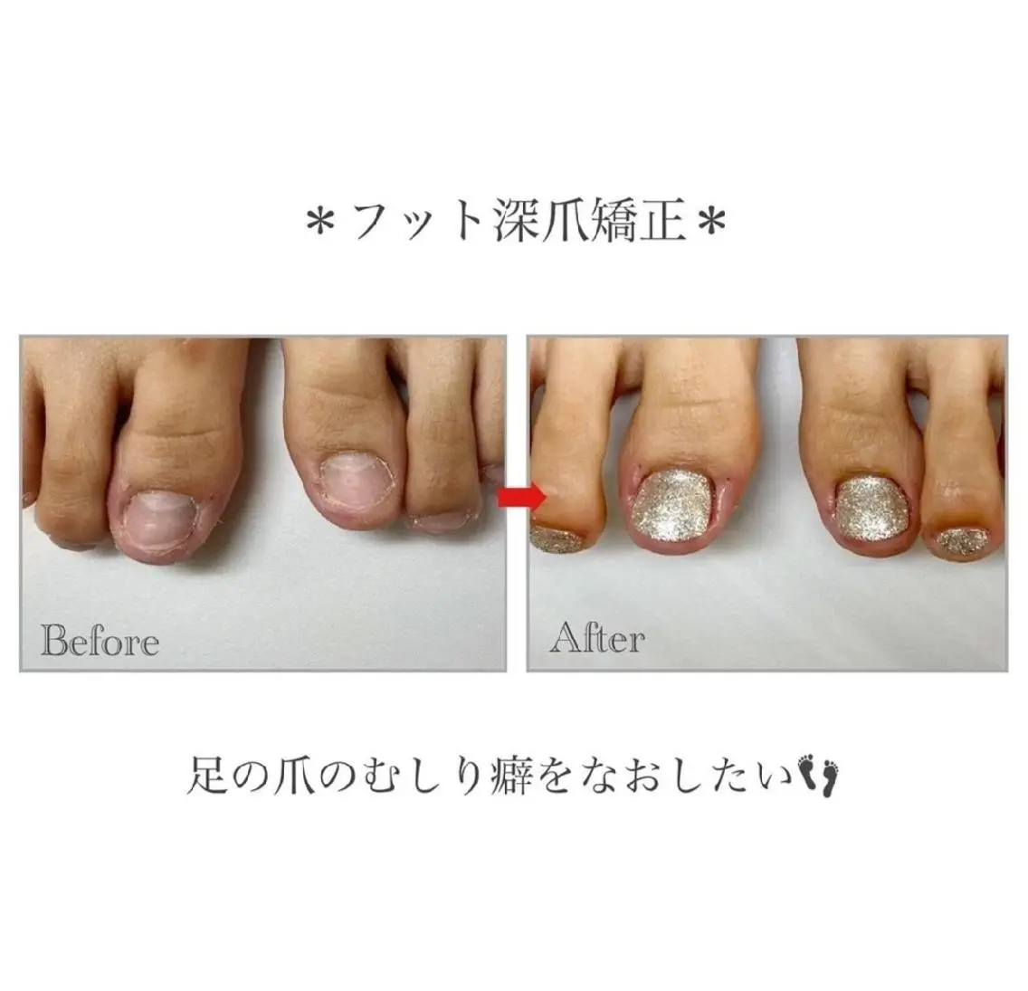 ネイル フットネイル ネイルサロン アリュームのネイルデザイン