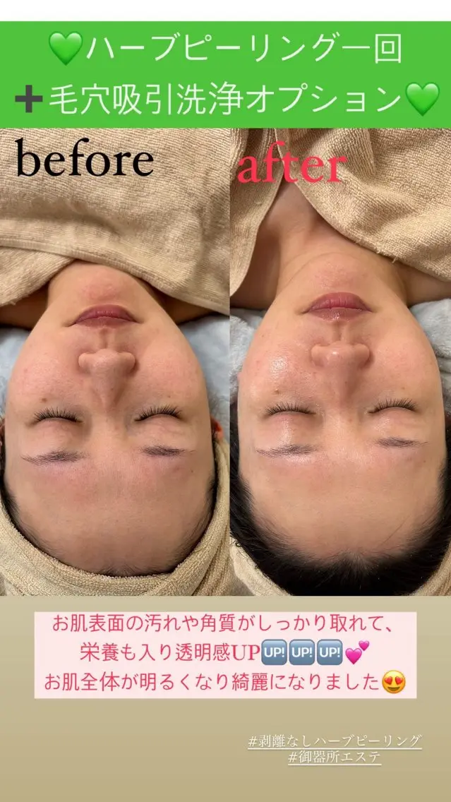 メンズ エステ Salon de Lino 御器所のエステ・リラクイメージ