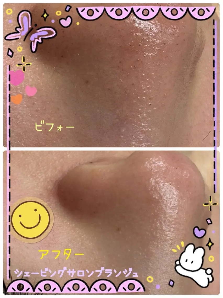 【毛穴・角質ケア】美肌シェービング+炭酸ヘッドドライスパの写真