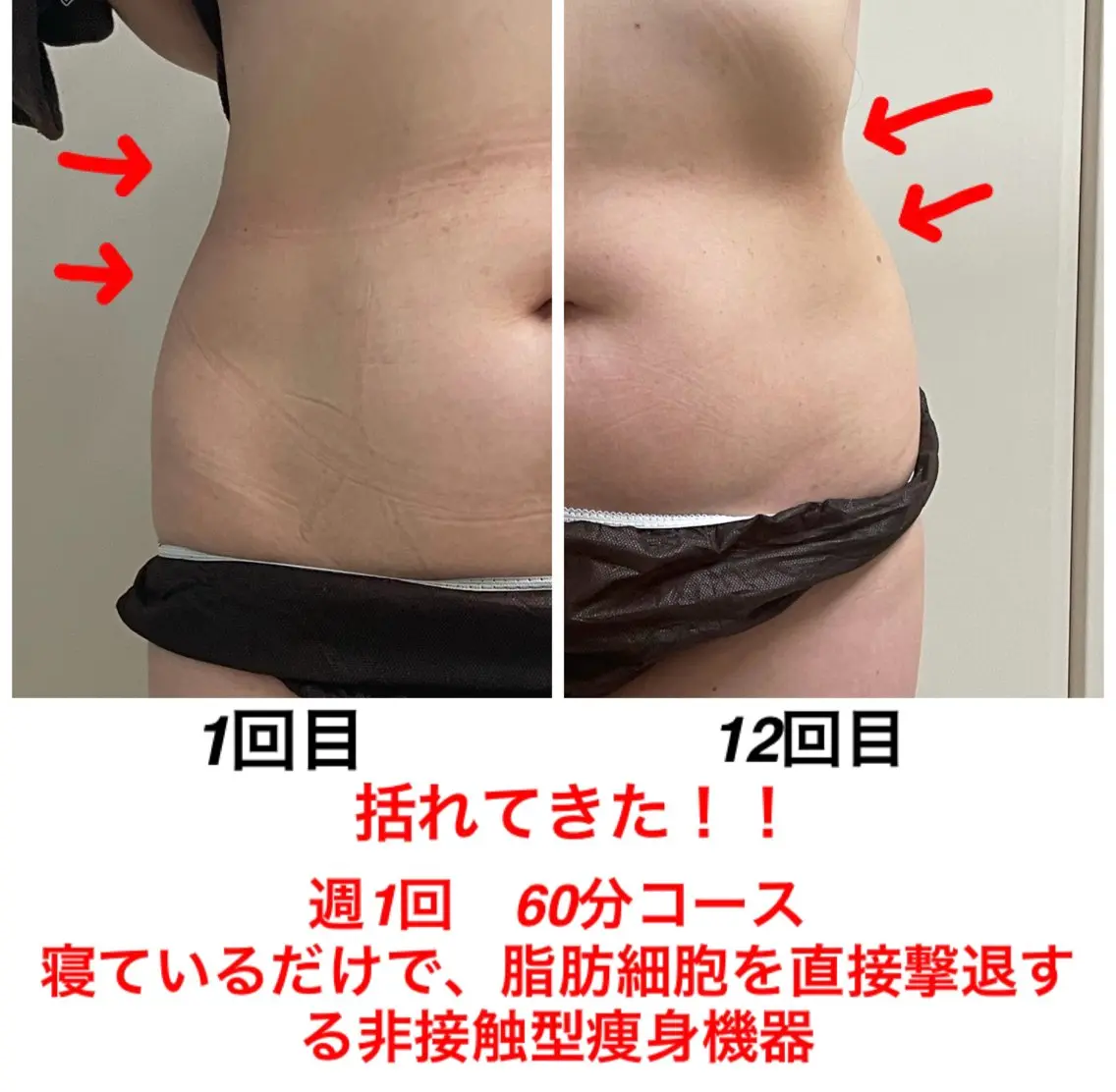 エステ ネイル・エステサロン UILANIのエステ・リラクイメージ
