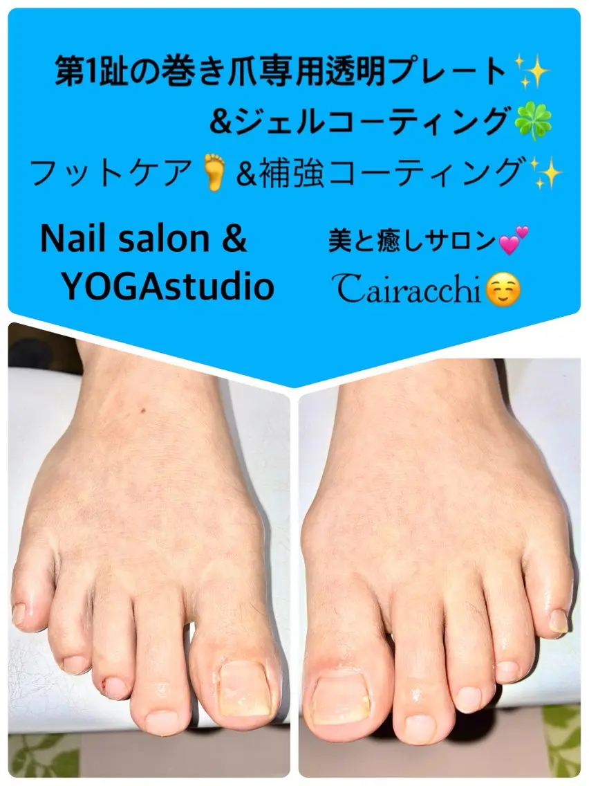 ネイル フットネイル Tairacchi タイラッチのエステ・リラクイメージ