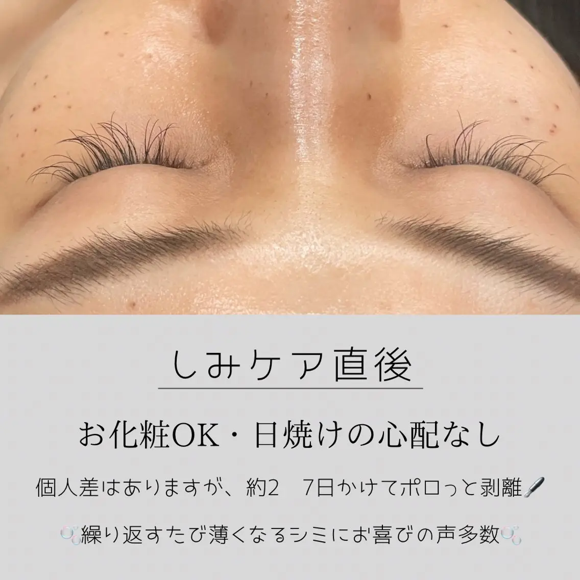 LiZA エステティックサロンのエステ・リラクイメージ