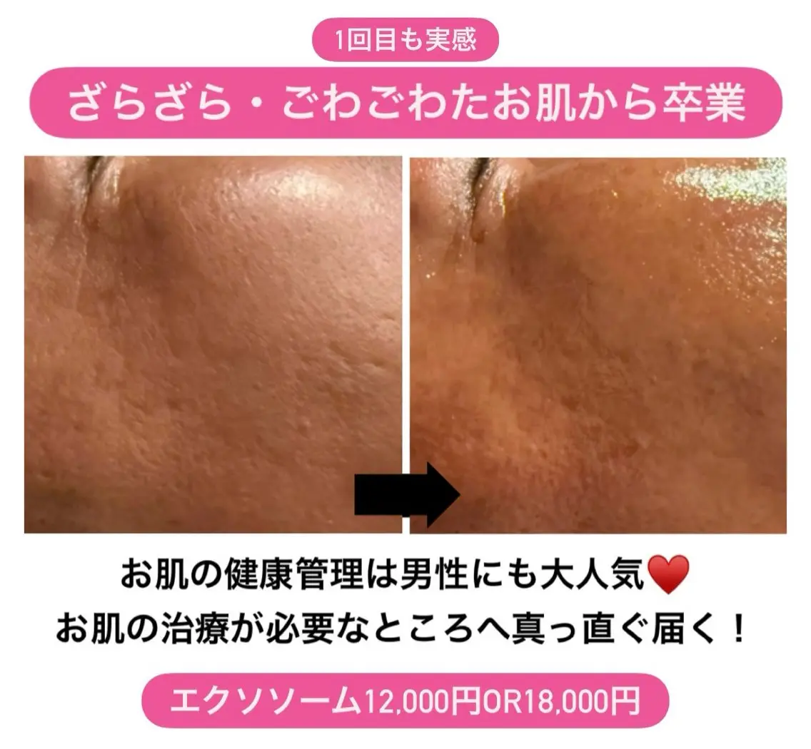 エステ 太田 女久美のエステ・リラクイメージ