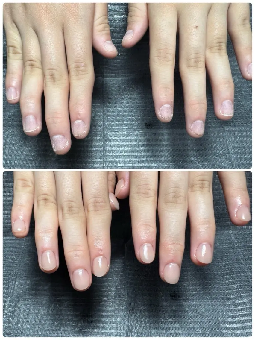 【深爪】美爪育成3回コース✨の写真