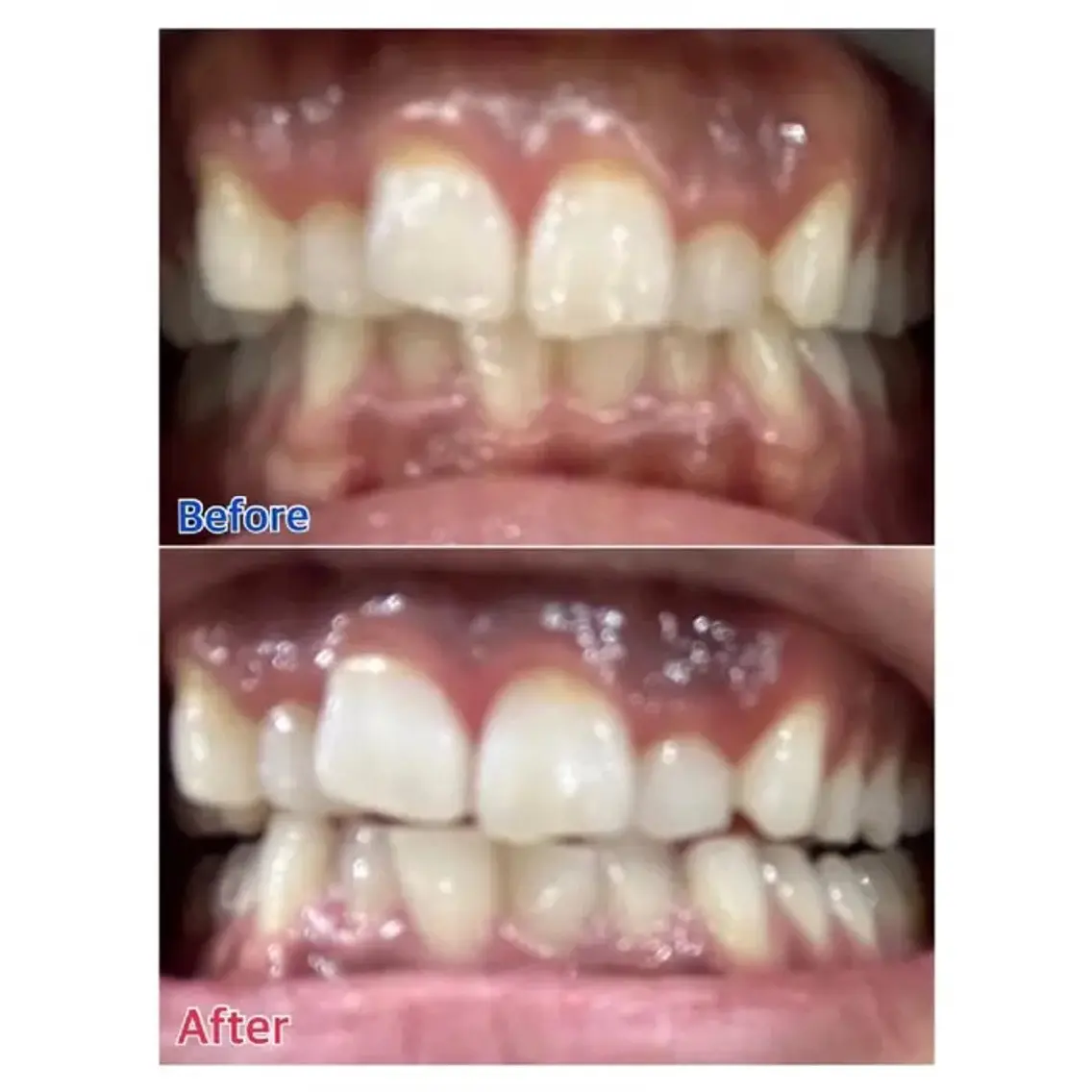 M渋谷 セルフホワイトニングのエステ・リラクイメージ