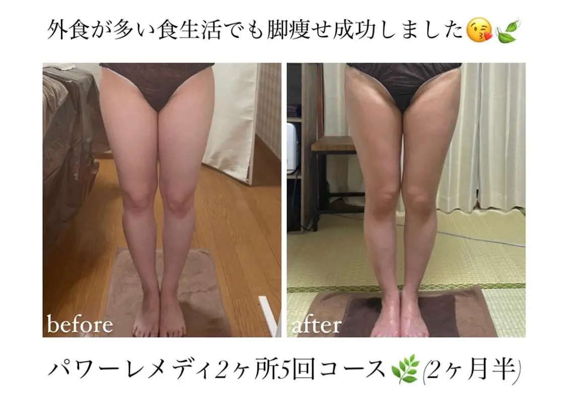 《本気痩せ×疲労改善 》 BILOOPのエステ・リラクイメージ