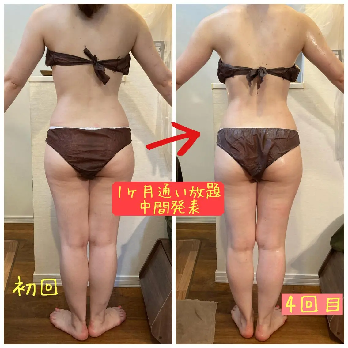 ♥️写真モニター募集♥️※条件は詳細を要確認⚠️ダイエットに体質改善に!パワフル全身施術😋の写真