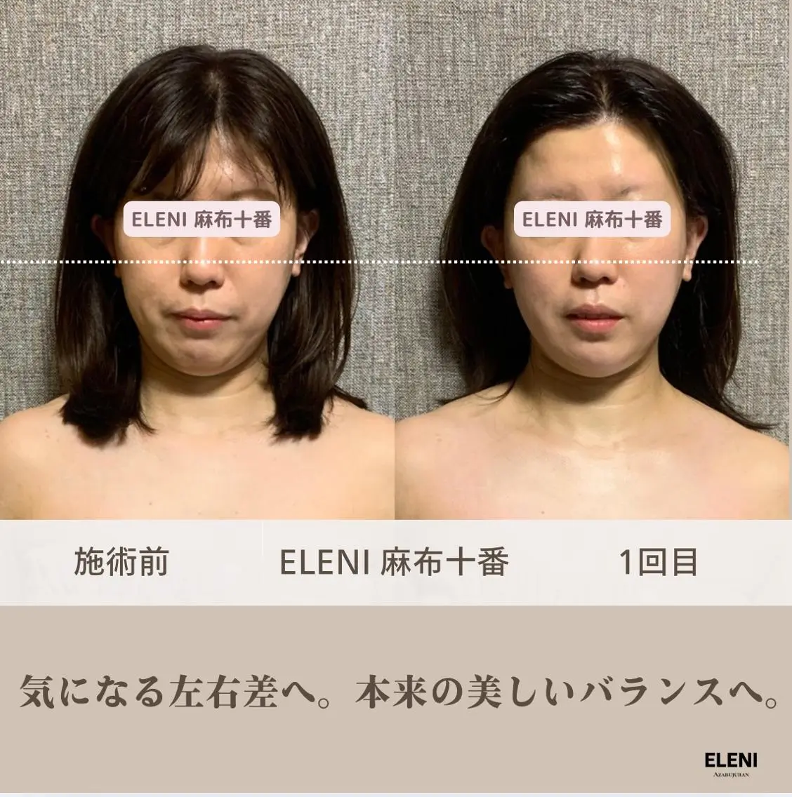麻布十番小顔コルギ 姿勢矯正リアン💗のエステ・リラクイメージ