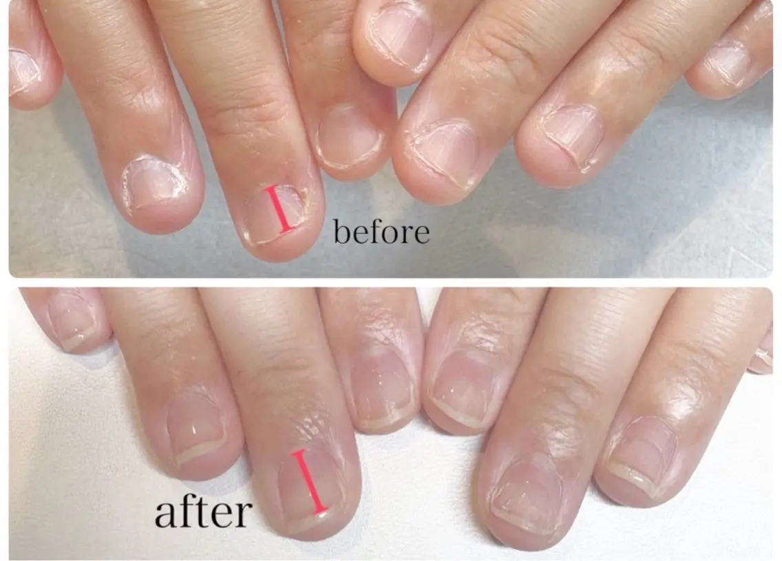 【hand】深爪などでお困りの方＊自爪育成+ワンカラー¥12.500→¥10.500！の写真