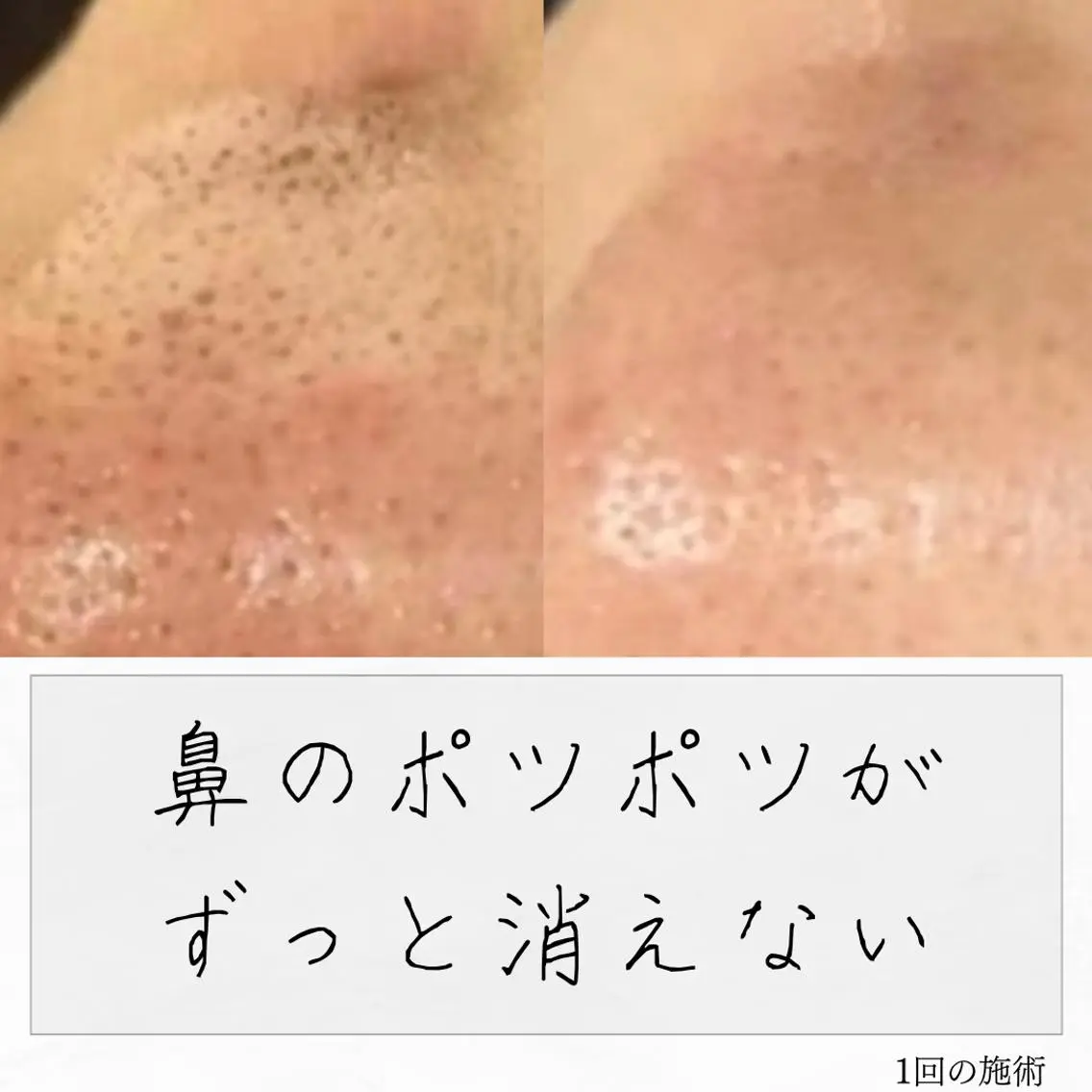 ニキビ経験者が施術 する専門サロン🌻のエステ・リラクイメージ