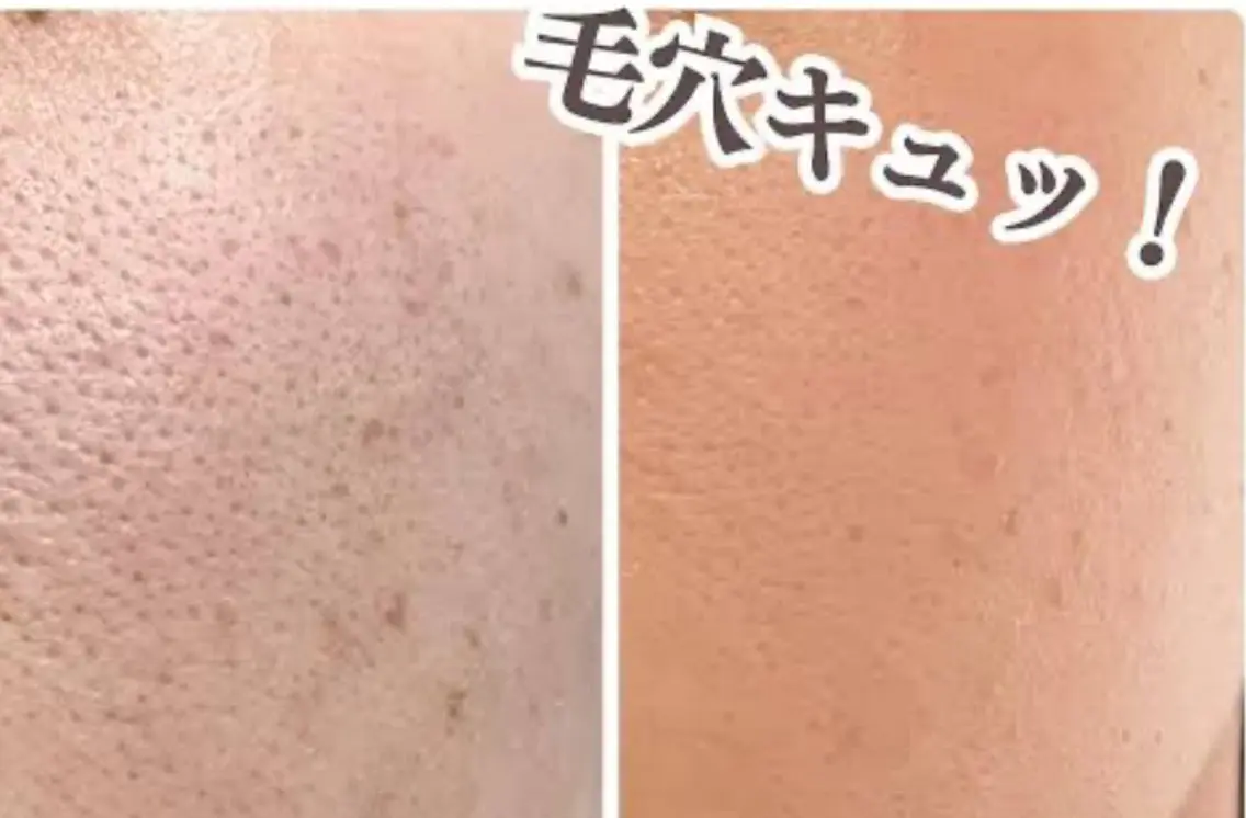 美BELLO 池袋のエステ・リラクイメージ