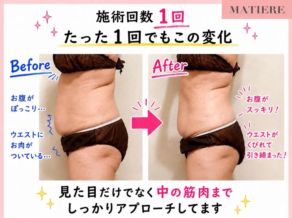 エステ 痩身&リラク 🌿MATIÈREのエステ・リラクイメージ