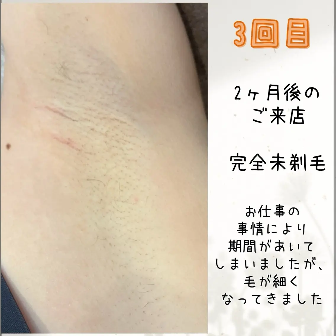 脱毛 脱毛&リラク FIS福岡薬院店のエステ・リラクイメージ