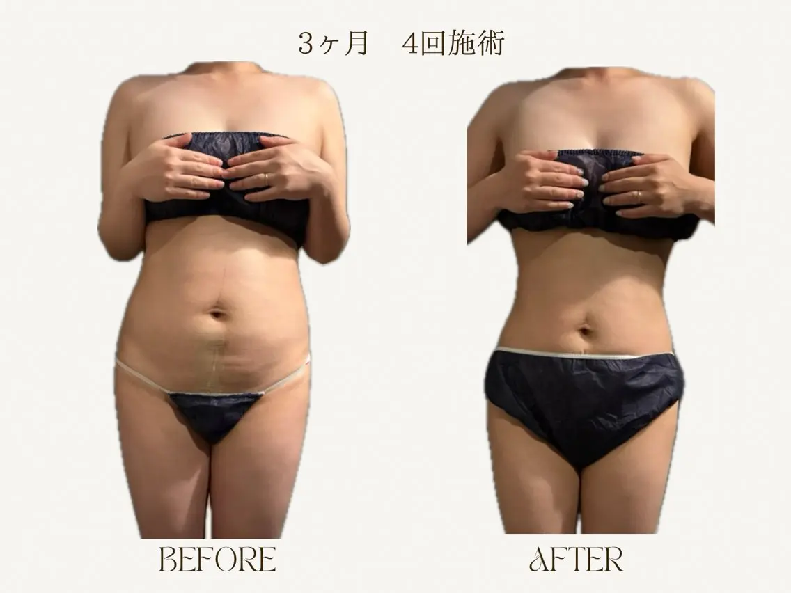 エステ salon de・ Belleのエステ・リラクイメージ