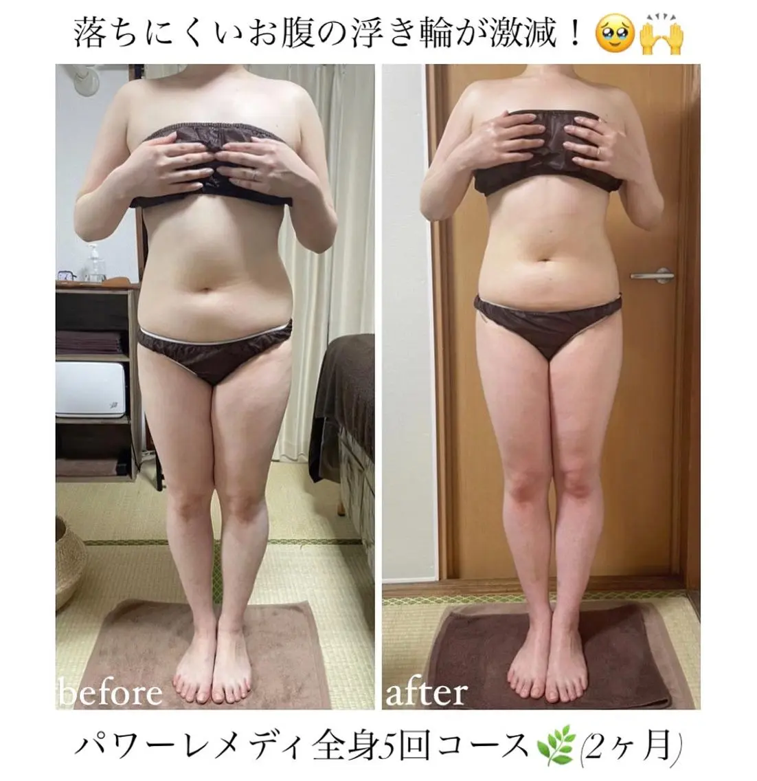《本気痩せ×疲労改善 》 BILOOPのエステ・リラクイメージ