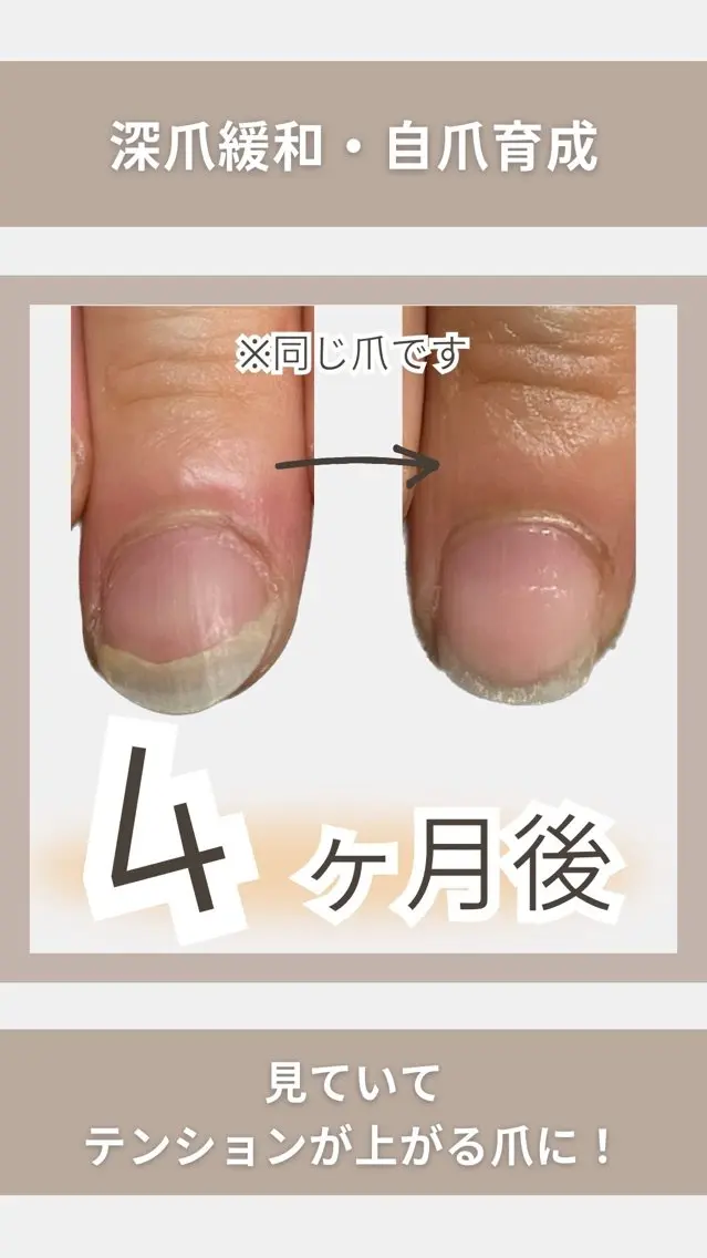 ネイル KIKOA NAIL キコアネイルのネイルデザイン