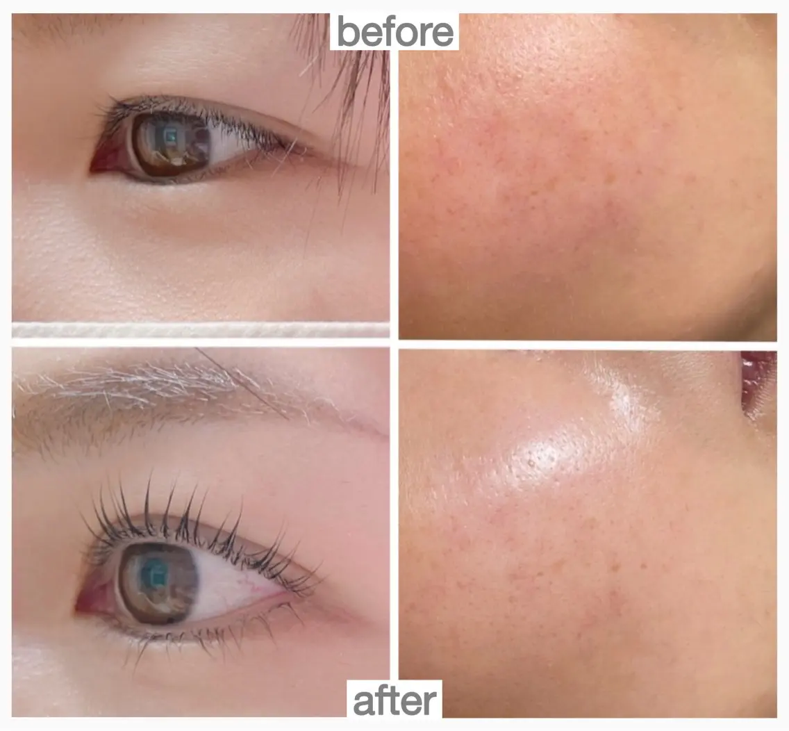 ながら美容で目元もお肌も綺麗に🫧✶⋆.˚  アイリッドアップパーマ×角質ケアピーリングの写真