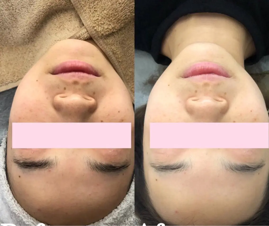 マツエク・マツパ エステ 愛維美水光美肌専門店 メンズレディースokのエステ・リラクイメージ