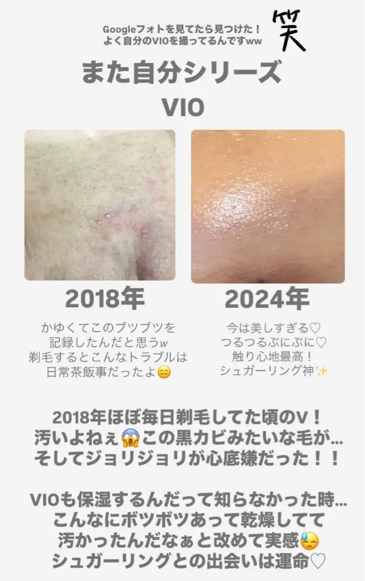 豊橋 ｜Hitomi シュガーリング専門店のエステ・リラクイメージ