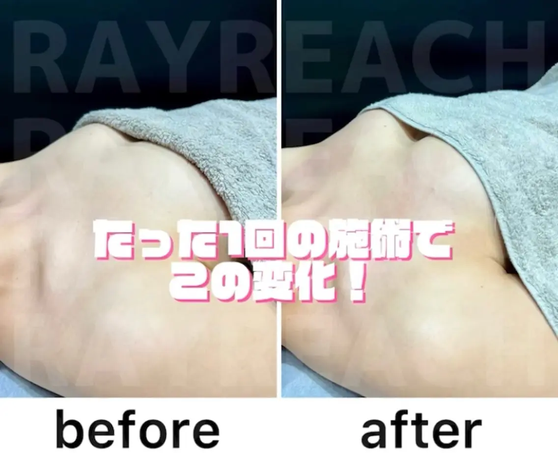 🙆♀️バストアップ☆豊胸します🎵の写真