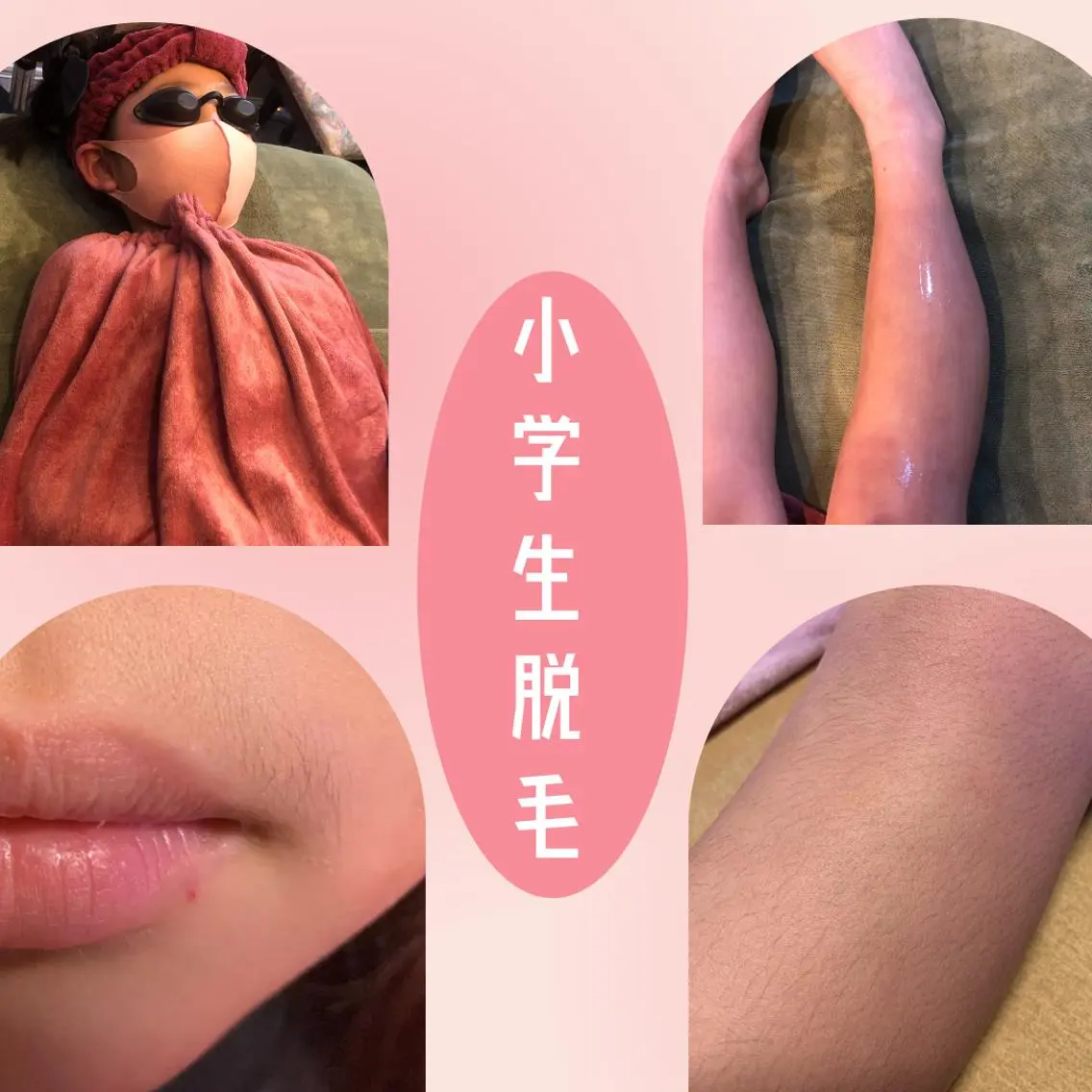 キッズ salon mijoaのエステ・リラクイメージ