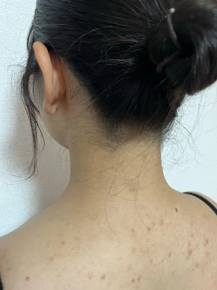 脱毛 フェムケアサロン MIREIのエステ・リラクイメージ