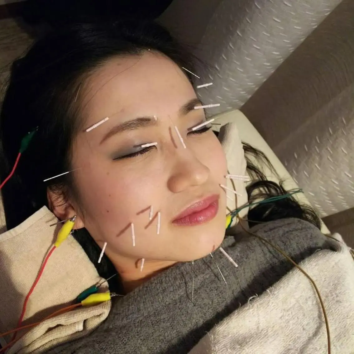 むくみたるみ専門☆ 美容鍼・小顔矯正のエステ・リラクイメージ