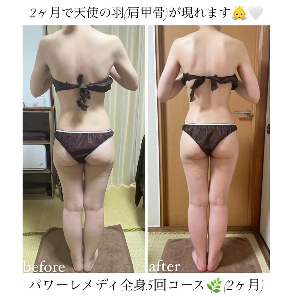 《本気痩せ×疲労改善 》  BILOOPのエステ・リラクイメージ