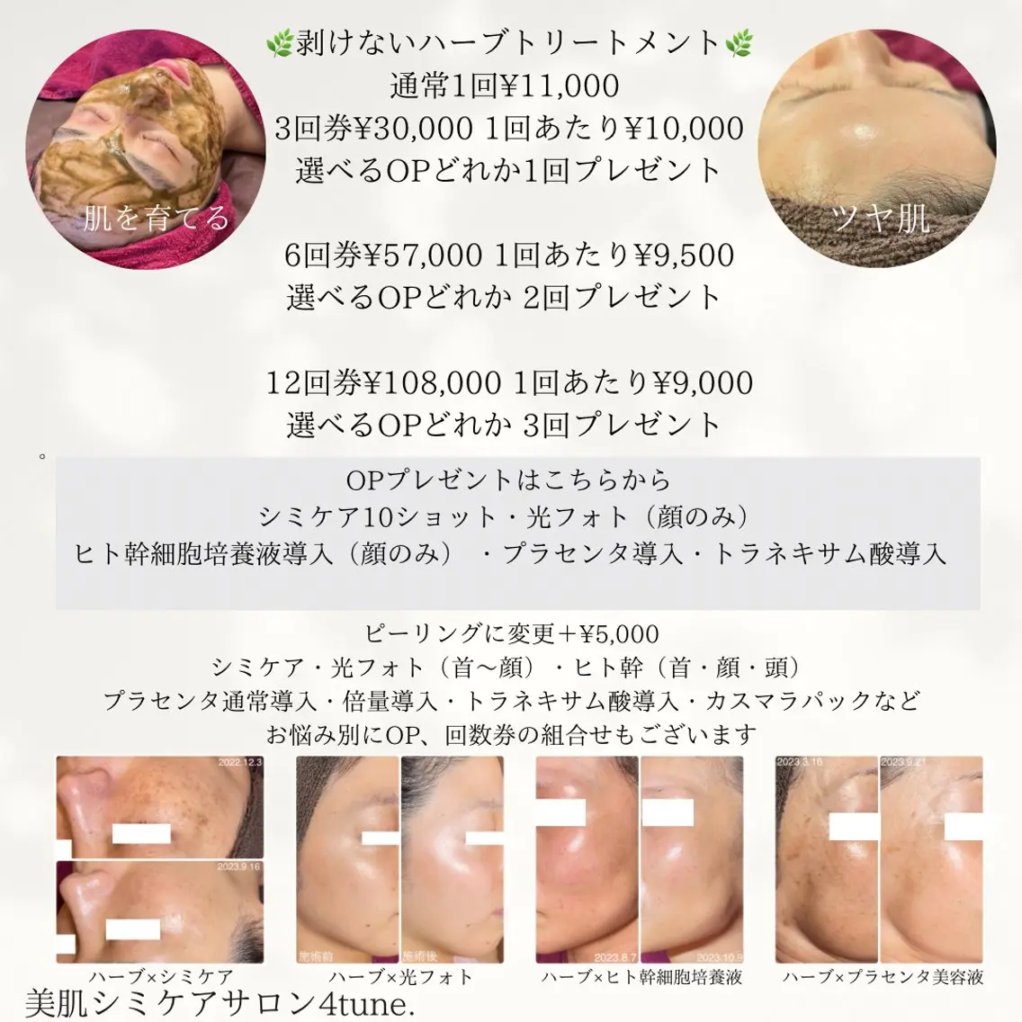美肌シミケアサロン 4tune.RUMIのその他イメージ
