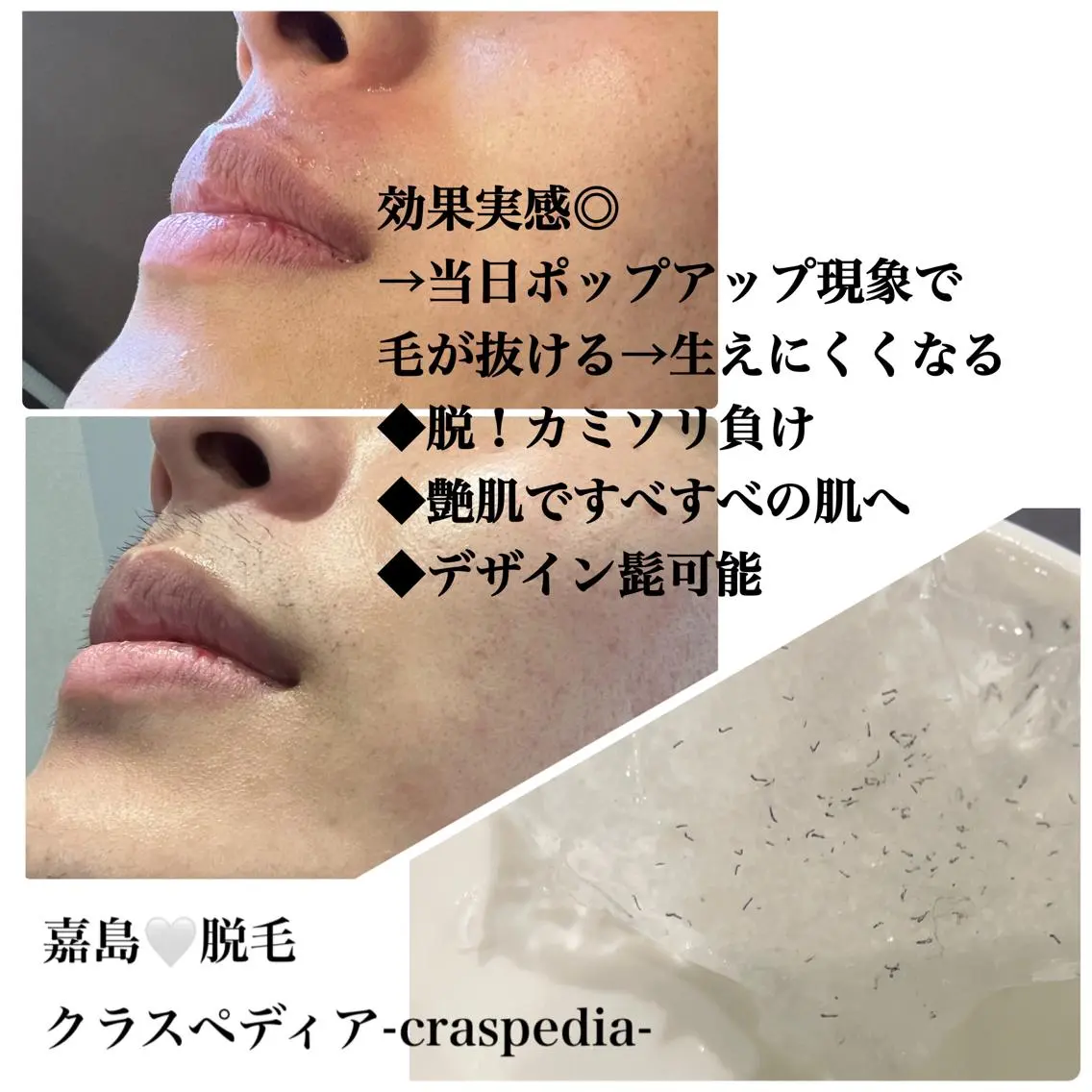 脱毛 クラスペディア脱毛 ・フェイシャル専門店のエステ・リラクイメージ