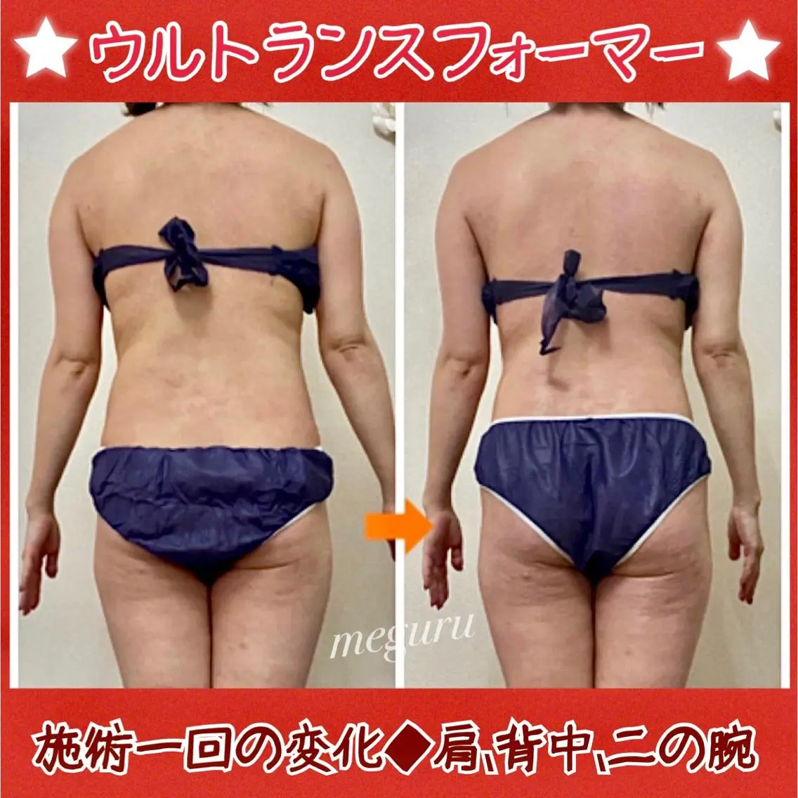 ショート カラー パーマ ヘアアレンジ メンズ キッズ ネイル マツエク・マツパ エステ リラク 痩身&ボディ 結果出し🌟丹野のエステ・リラクイメージ