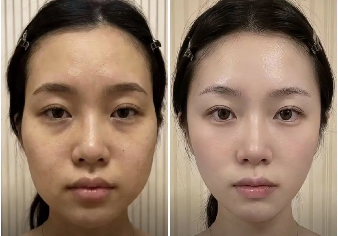 マツエク・マツパ エステ 愛維美水光専門店 川崎彩鳳のエステ・リラクイメージ