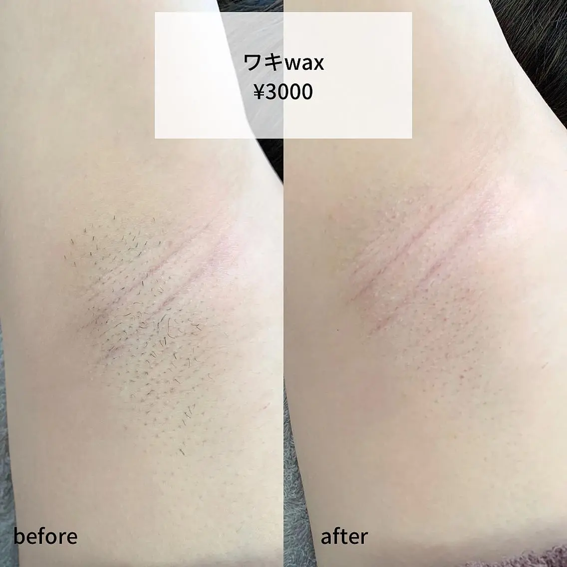メンズ 脱毛 稲嶺 美華のエステ・リラクイメージ