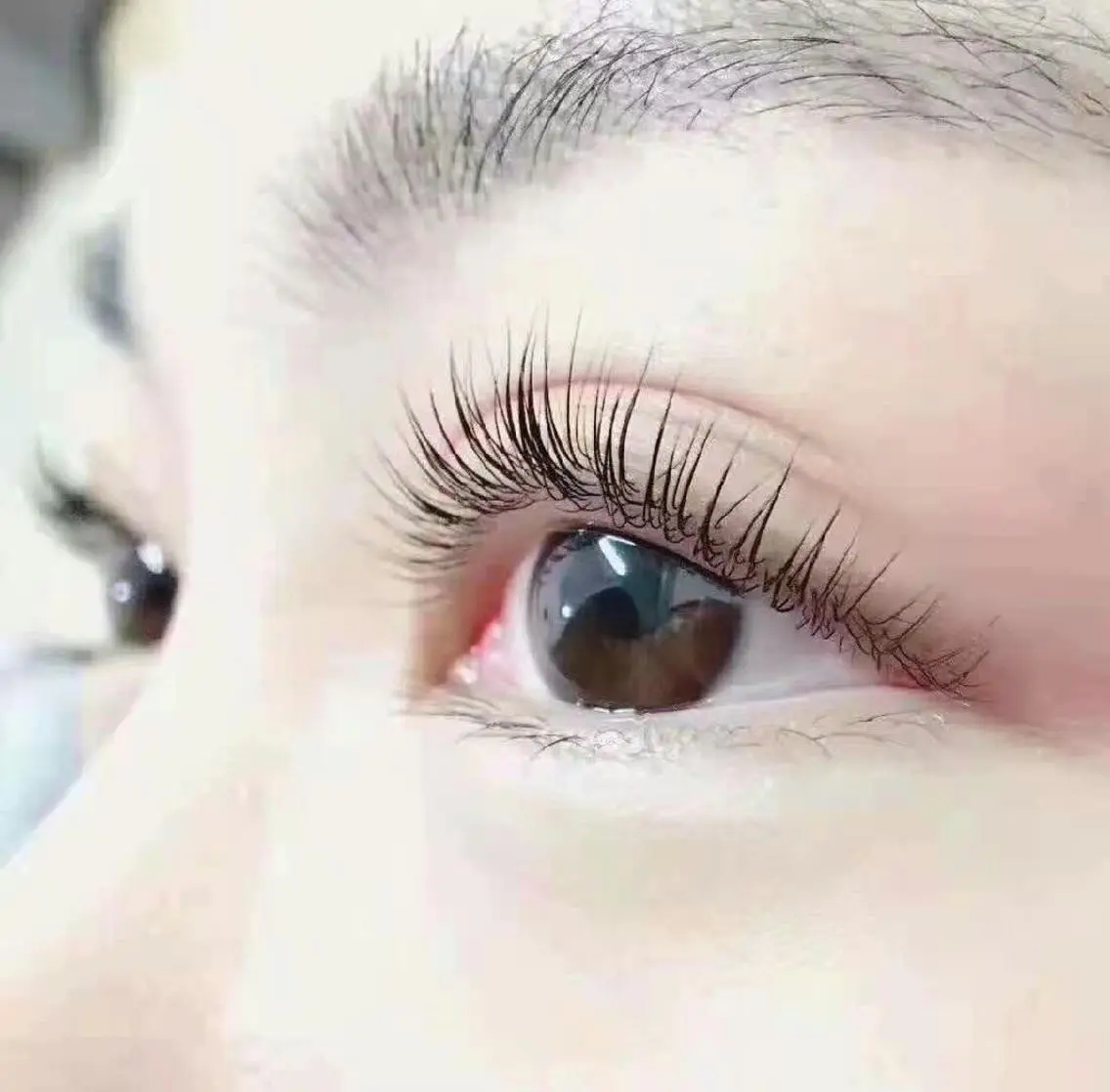 マツパ眉毛脱毛の写真