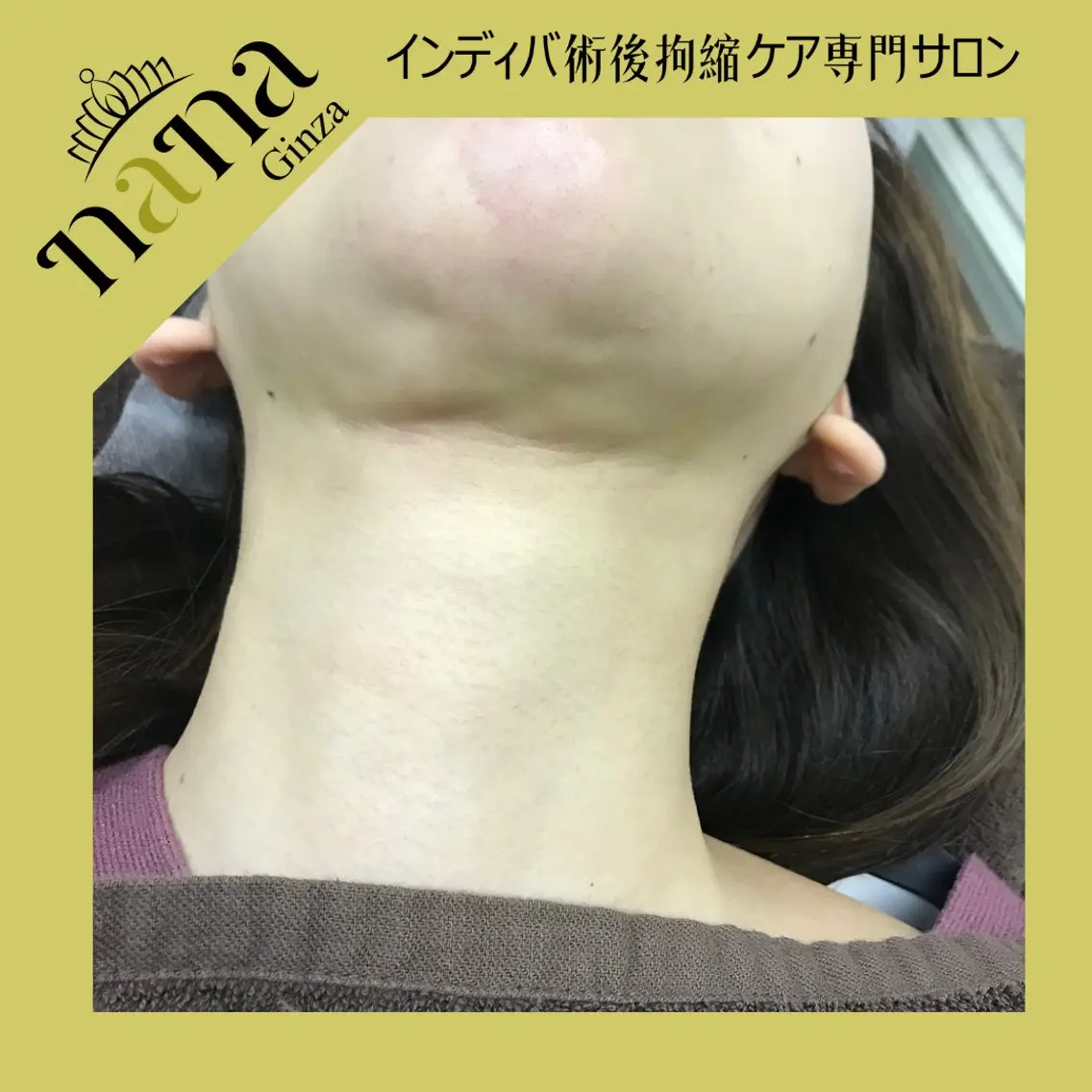 エステ Nana銀座Nina 高周波温熱専門サロンのエステ・リラクイメージ