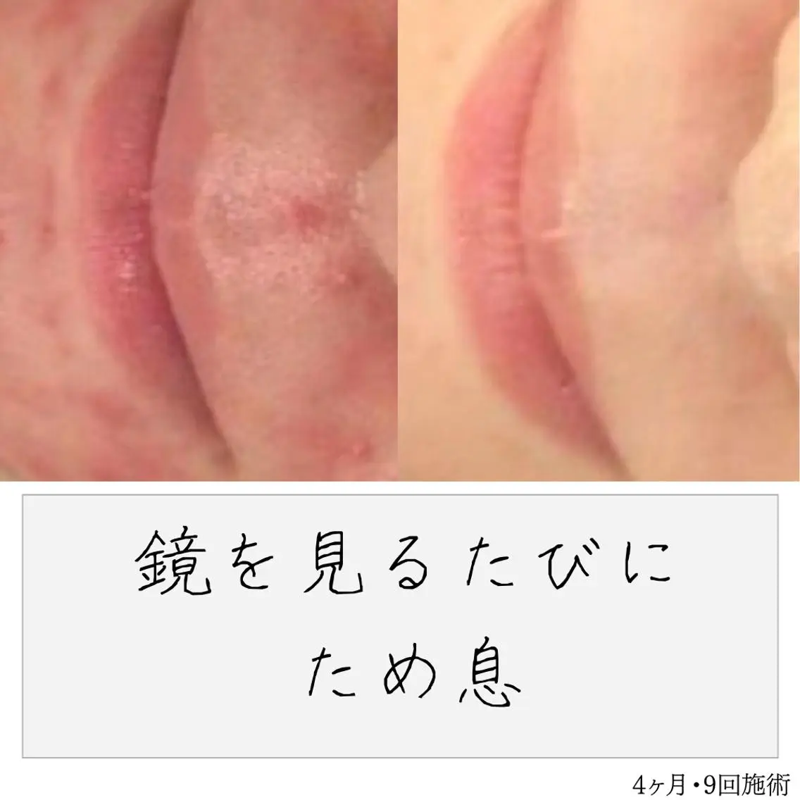 ニキビ経験者が施術 する専門サロン🌻のエステ・リラクイメージ