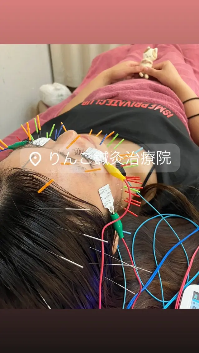 その他 美容鍼灸女性専用 りんご鍼灸治療院のエステ・リラクイメージ