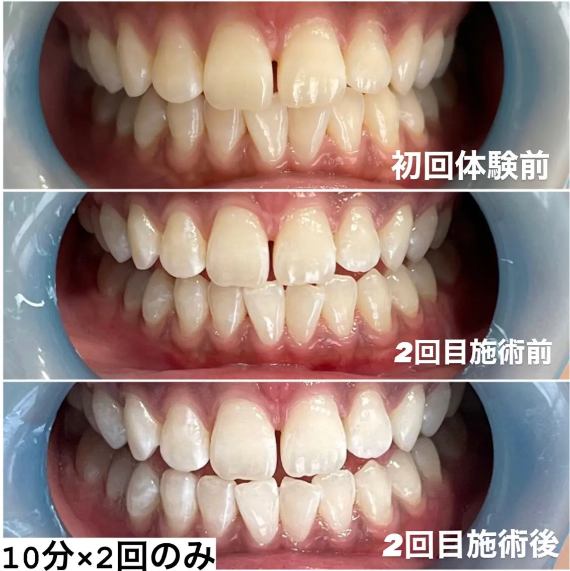その他 ホワイトニング専門店 Hi-Whiteのその他イメージ