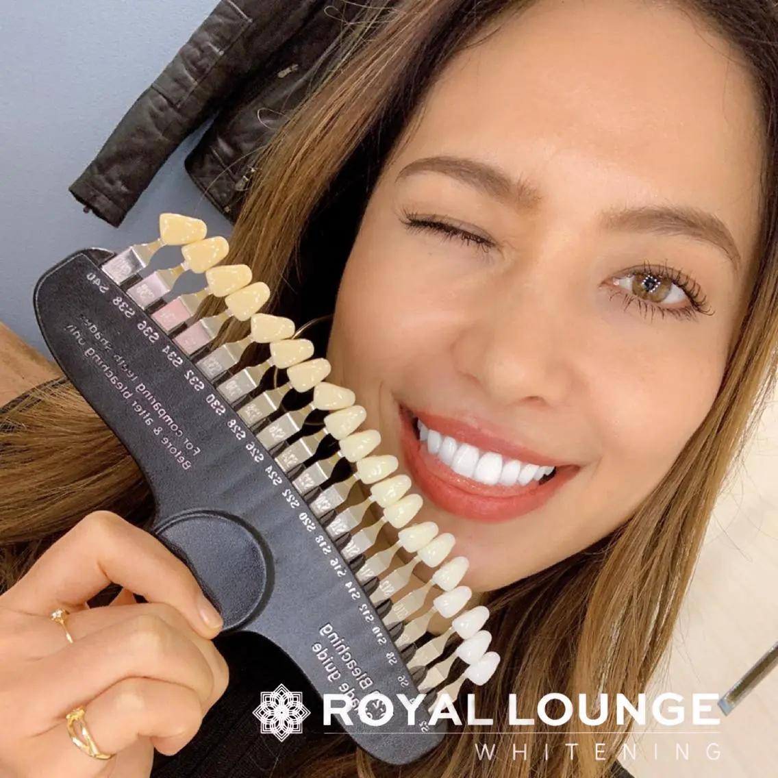 プレゼント付き🎁ホワイトニング🦷【ライトプレミアムホワイトニング】✨6回照射2来店　プレミアムジェル代別途の写真