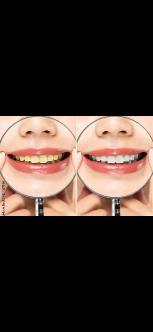 WHITENING ハウスのマツエク・マツパデザイン