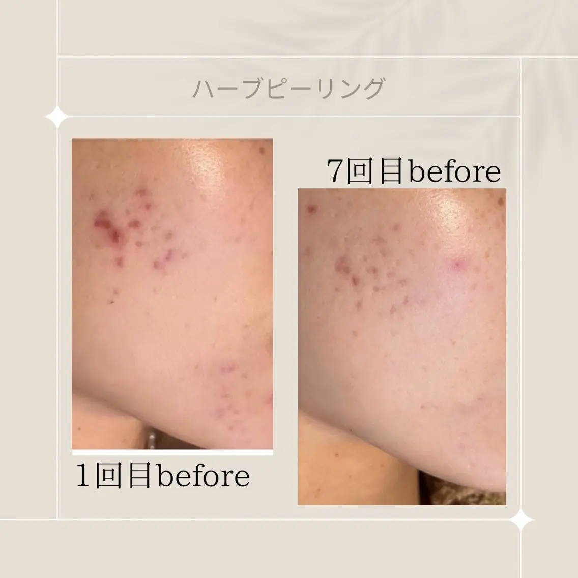 エステ リラク ピーリング専門店 Belluteのエステ・リラクイメージ