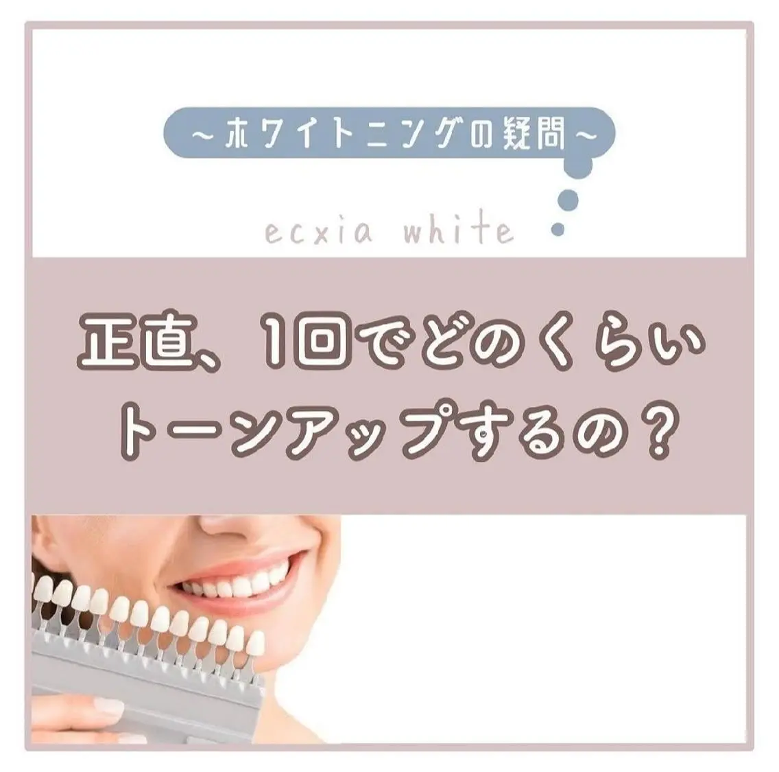その他 セルフホワイトニング エクシア大宮東口店のその他イメージ