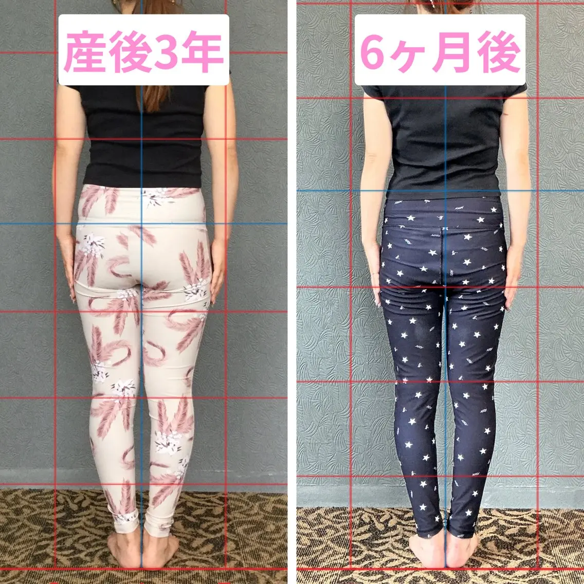 エステ 【産後/痩身】 ピラティス整体院ヴレのエステ・リラクイメージ