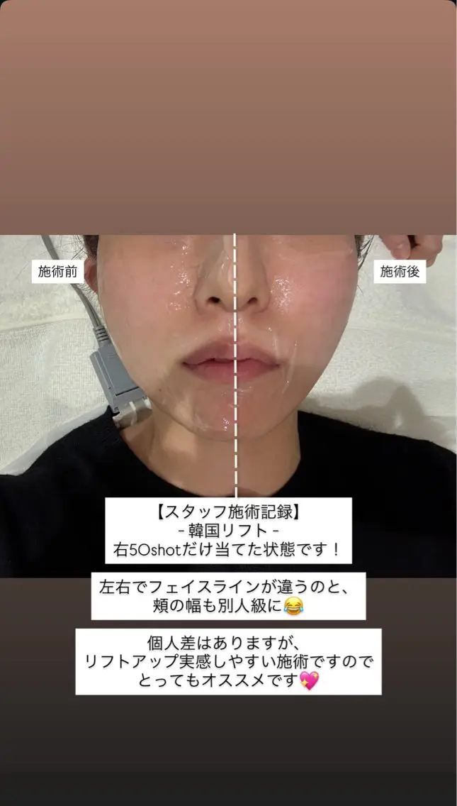 マツエク・マツパ エステ 愛維美水光美肌専門店 メンズレディースokのエステ・リラクイメージ